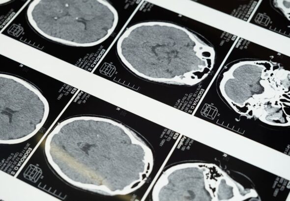 Radiology Tech Prerequisites: Your Guide to a Rewarding Career